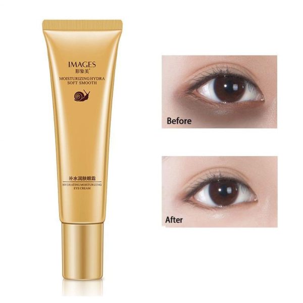 کرم دور چشم حلزون ایمیجز