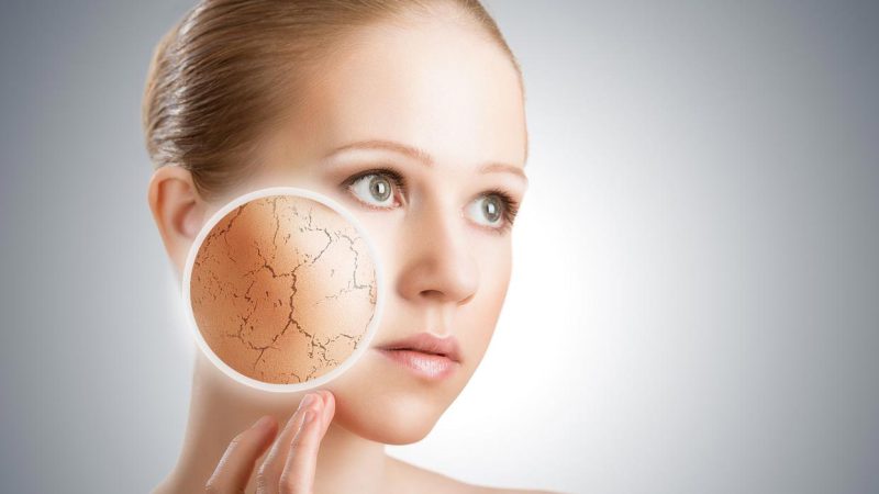 خشکی پوست صورت